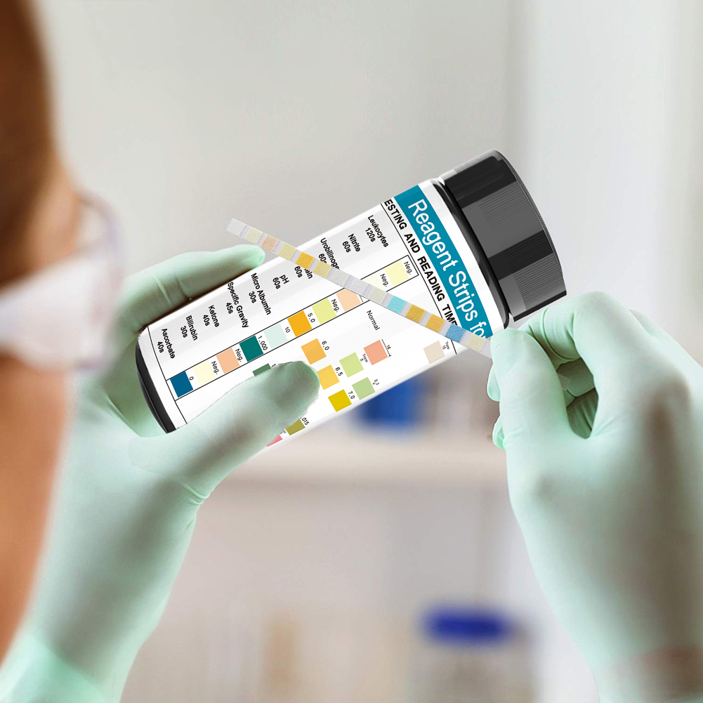 100 strisce Strisce reattive p - Urinalysis Reagent Strip recensione e prezzo