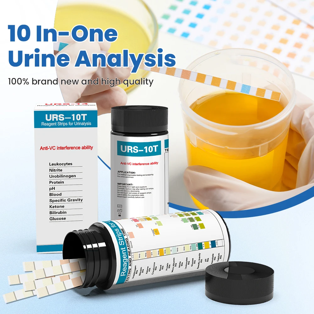 Strisce reattive per analizzat - Urinalysis Reagent Strip recensione e prezzo
