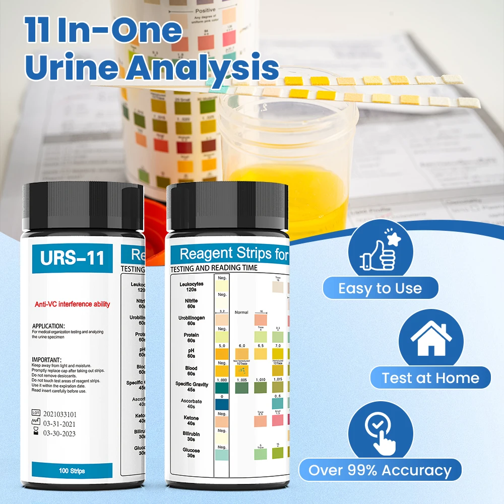 Strisce reattive per analizzat - Urinalysis Reagent Strip recensione e prezzo