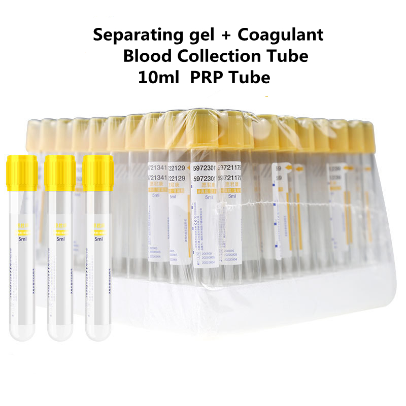 Tubo monouso per la raccolta d - Medical Lab Blood Test recensione e prezzo